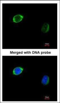 RAB2B Rabbit Polyclonal Antibody