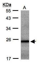 RAB2B Rabbit Polyclonal Antibody