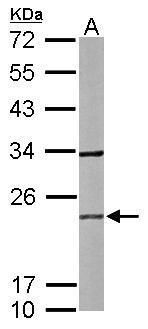 RAB2B Rabbit Polyclonal Antibody