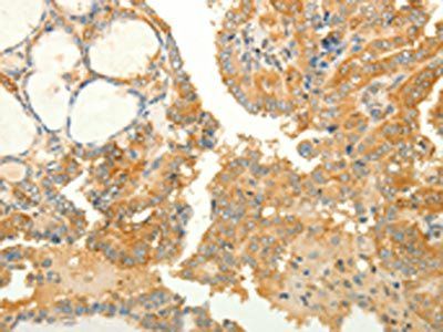 RAB35 Antibody
