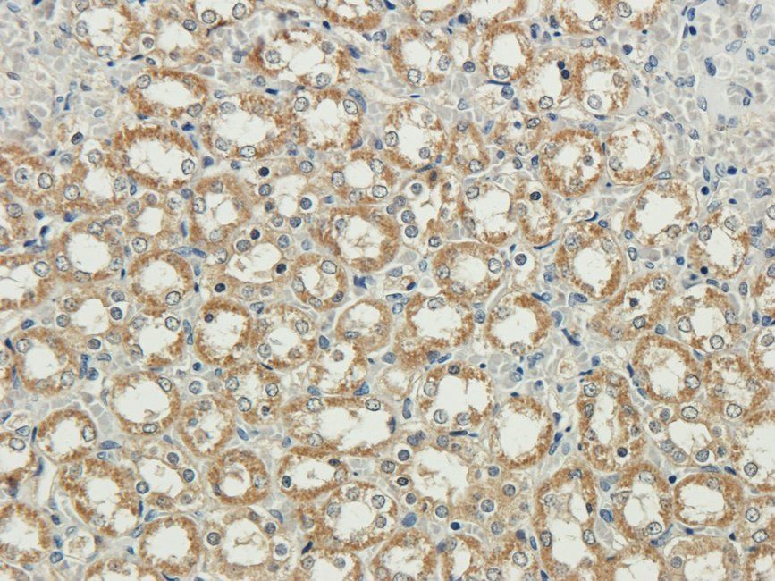 RAB5A Rabbit Polyclonal Antibody