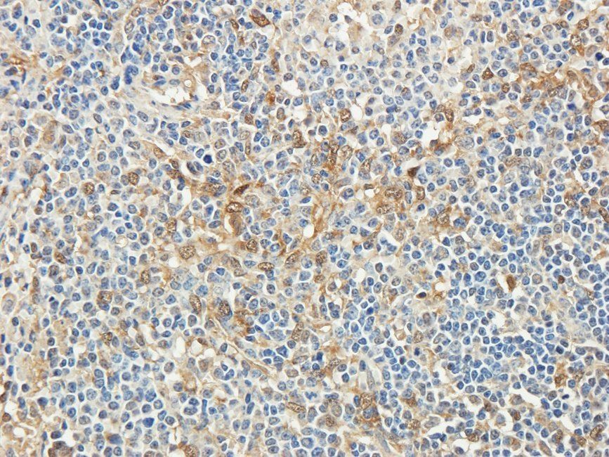 RAB5A Rabbit Polyclonal Antibody