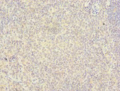 RAB6B Antibody
