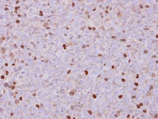 RACGAP1 Rabbit Polyclonal Antibody