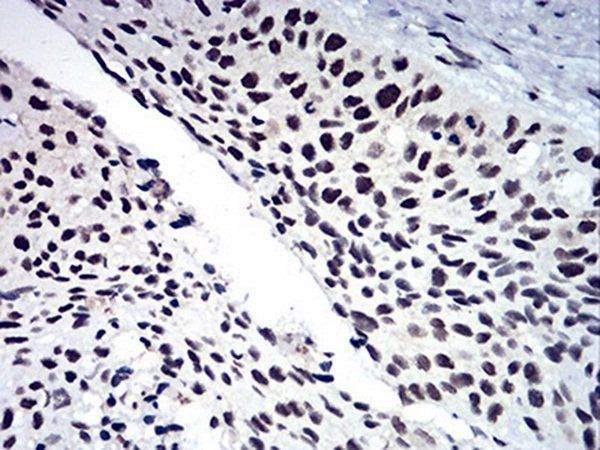 RAD50 Antibody