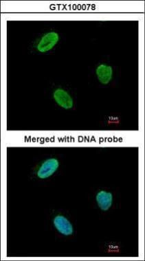 Rad9 Rabbit Polyclonal Antibody