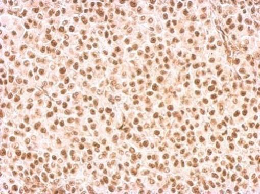 Rad9 Rabbit Polyclonal Antibody