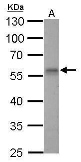 Rad9 Rabbit Polyclonal Antibody