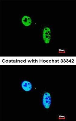 RAG2 Rabbit Polyclonal Antibody