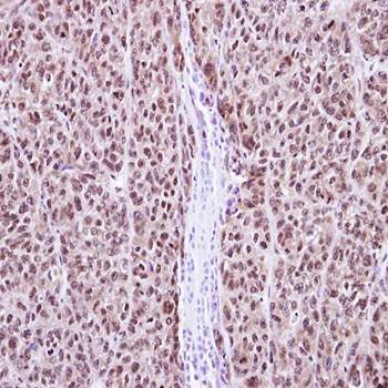 RAG2 Rabbit Polyclonal Antibody