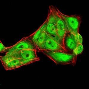 RAN Antibody