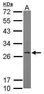 RanBP1 Rabbit Polyclonal Antibody