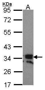 RANKL Rabbit Polyclonal Antibody
