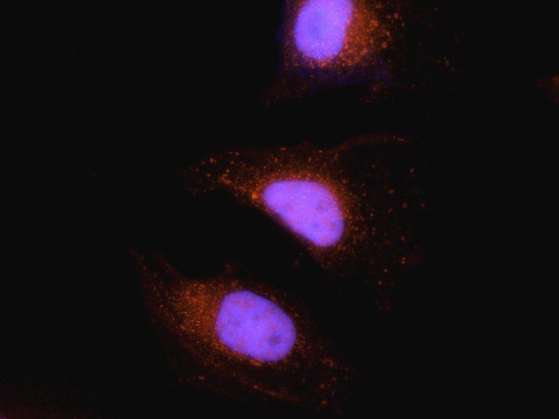 RANTES Rabbit Polyclonal Antibody