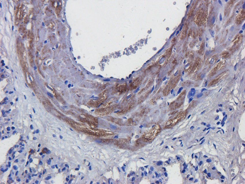 RANTES Mouse Monoclonal Antibody