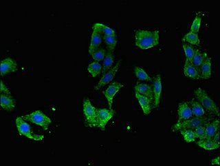 RASGRP1 Antibody