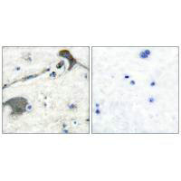 NRAS/HRAS/KRAS Antibody