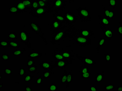 RBBP4 Antibody
