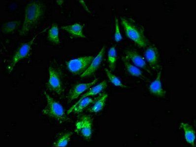 RBBP6 Antibody