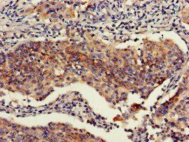 RBBP6 Antibody