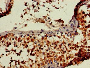 RBBP6 Antibody