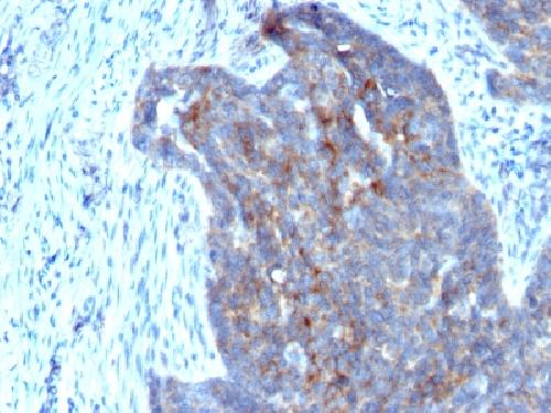 RBP1 Antibody