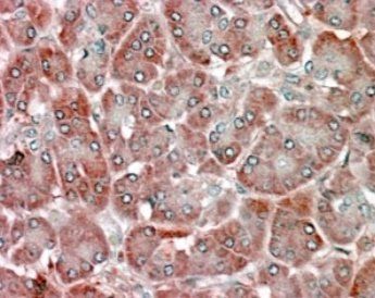 RBP1 Antibody