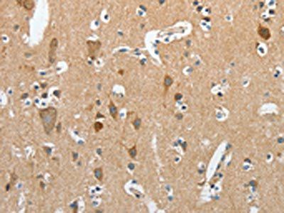 RCAN1 Antibody