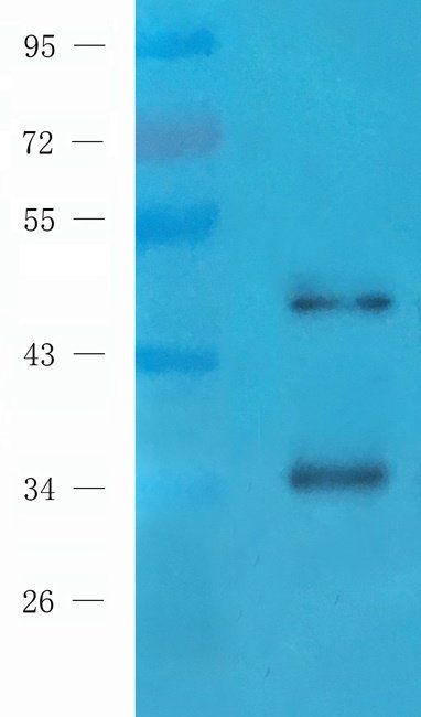 RCAN1 Rabbit Polyclonal Antibody