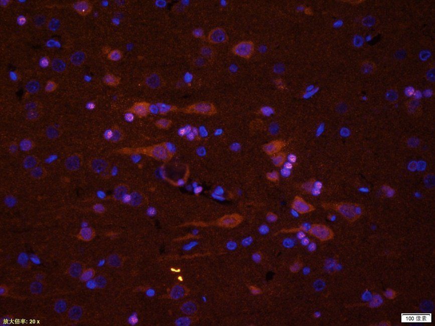 RCAN1 Rabbit Polyclonal Antibody