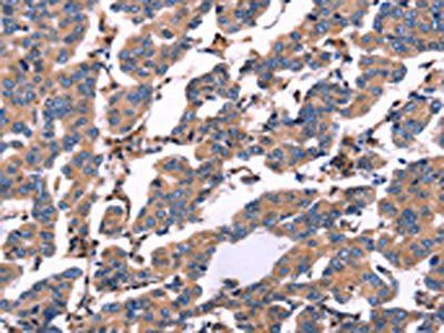 RDX Antibody