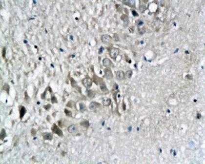 Reelin Rabbit Polyclonal Antibody