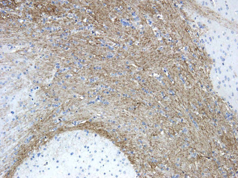 Reelin Rabbit Polyclonal Antibody