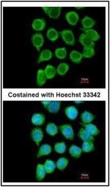 RELT TNF receptor Antibody