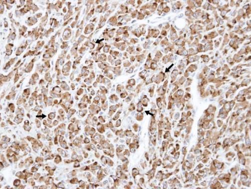 RELT TNF receptor Antibody