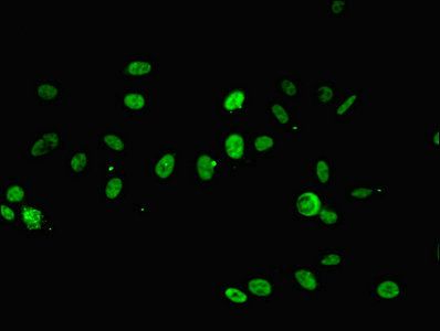 RPA2 Antibody