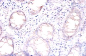 RPA2 Antibody