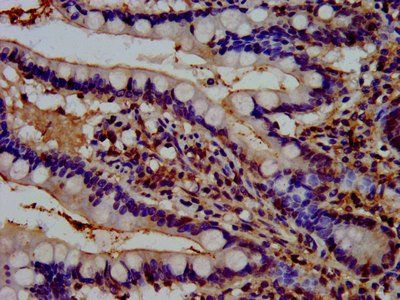 REPS1 Antibody
