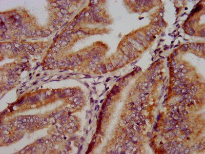 REPS1 Antibody