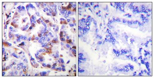 RFA2 (Phospho-Thr21) Antibody