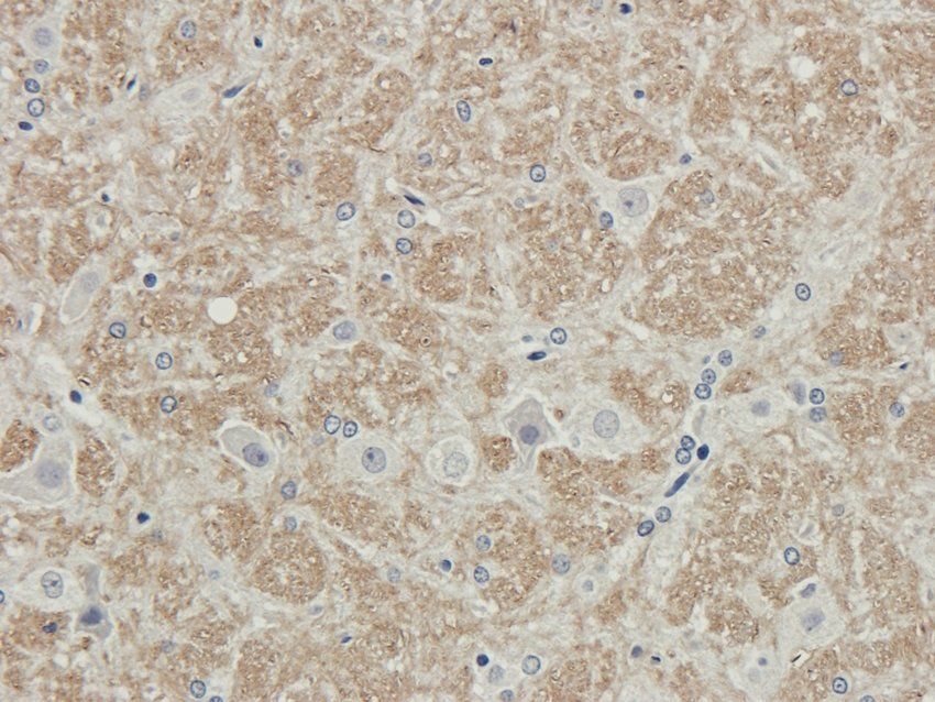 RHOT1 Rabbit Polyclonal Antibody