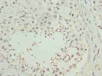 RHPN1-AS1 Antibody