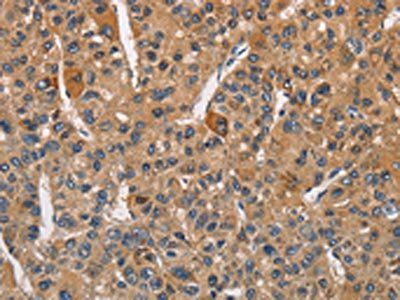 RICTOR Antibody