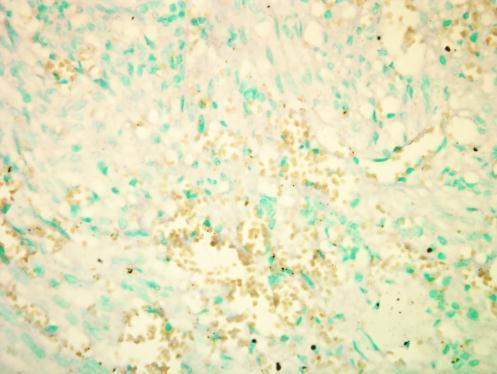 RPTOR independent companion of MTOR complex 2 Antibody