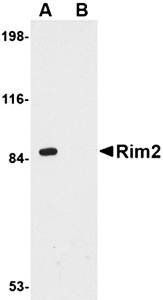 Rim2 Rabbit Polyclonal Antibody