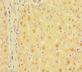 RIT1 Antibody