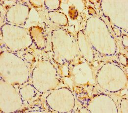 RIT1 Antibody