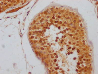 RNF20 Antibody