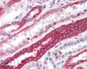 RNF34/RFI (N Terminus) Antibody