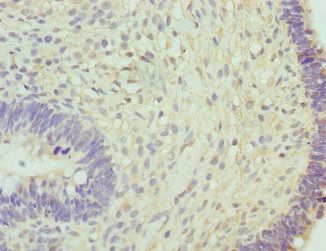 RNGTT Antibody